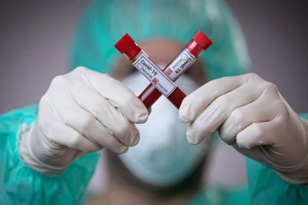 В Минусинске и Минусинском районе с начала эпидемии коронавируса заболело 83 человека