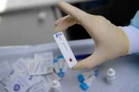 Медики озвучили результаты тестов на СПИД в Минусинске