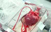 В Красноярском крае уже троим пациентам пересадили донорские сердца