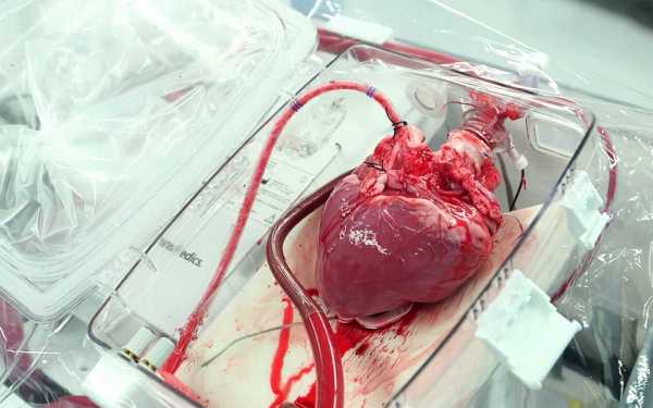 В Красноярском крае уже троим пациентам пересадили донорские сердца
