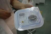 Медики Красноярска и Новосибирска впервые установили электроды пациенту с эпилепсией