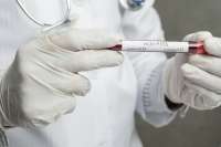 В Хакасии еще у 22 человек подтвердился диагноз «коронавирус»